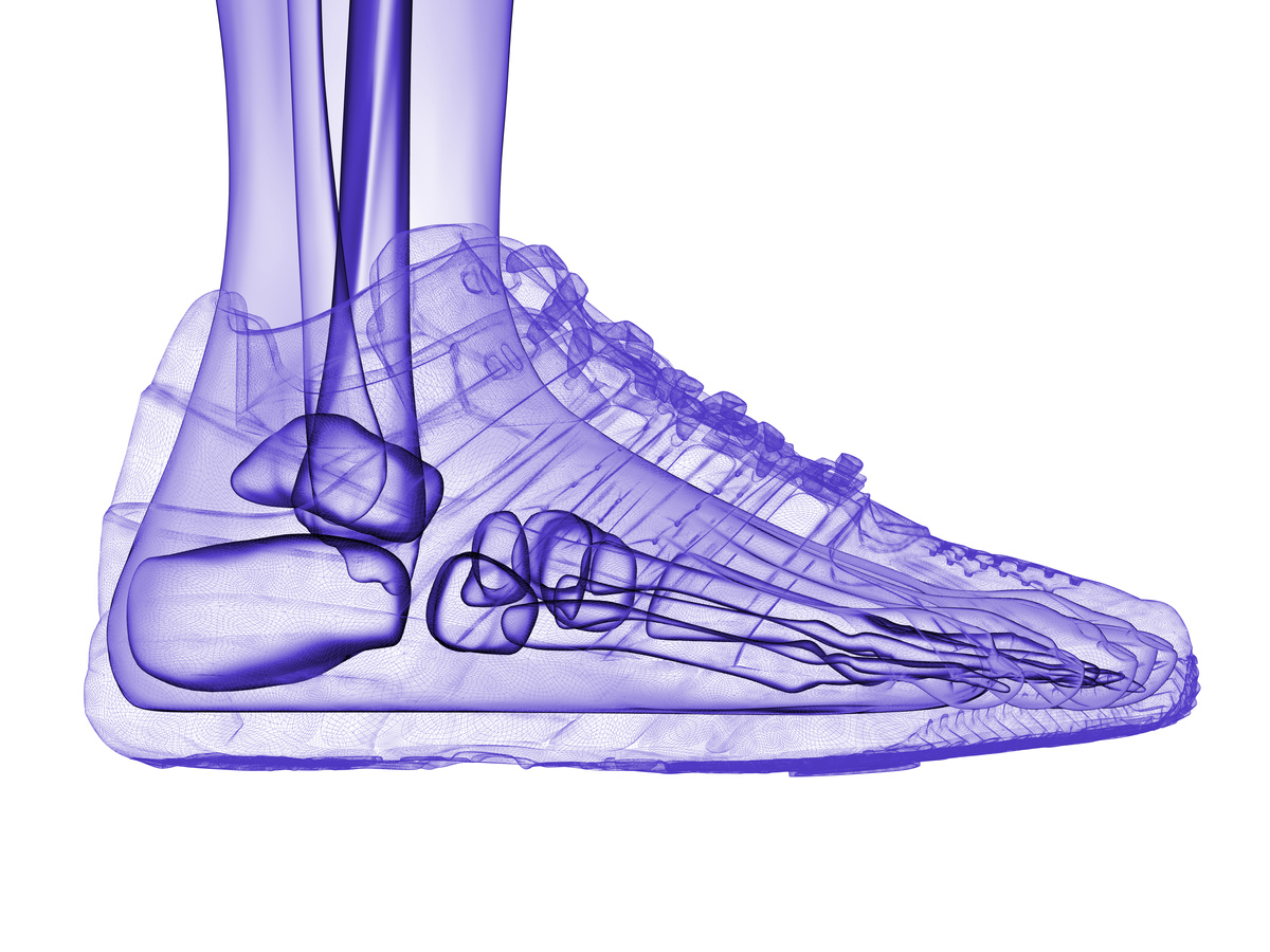 Orthopedic Shoe and Foot Bones